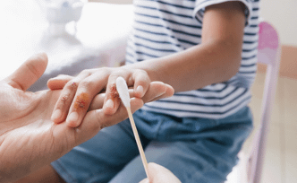 Wound Infections