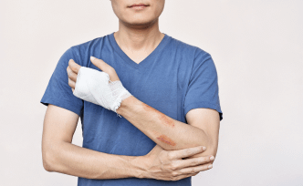 All You Need to Know About Wound Healing to Minimize Scarring