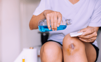 The Advantages of Povidone-Iodine (BETADINE®) Over Rubbing Alcohol for Wound Care