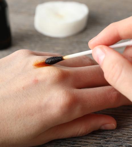 cotton swab with antiseptic treating the wound